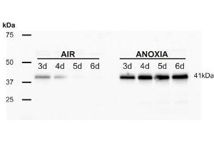 Western Blotting (WB) image for anti-Alcohol Dehydrogenase (ADH) antibody (ABIN619537) (Alcohol Dehydrogenase (ADH) 抗体)