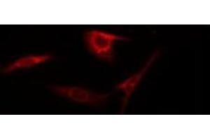 ABIN6275184 staining HepG2 by IF/ICC. (HNRPLL 抗体  (Internal Region))