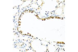 Immunohistochemistry of paraffin-embedded rat lung using APCS antibody at dilution of 1:100 (40x lens). (APCS 抗体)