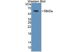 Detection of Recombinant RGS6, Rat using Polyclonal Antibody to Regulator Of G Protein Signaling 6 (RGS6) (RGS6 抗体  (AA 1-472))