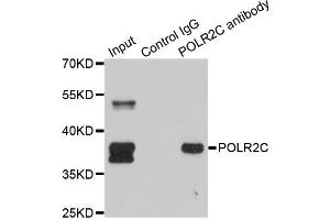 Immunoprecipitation analysis of 150ug extracts of SW620 cells using 3ug POLR2C antibody.