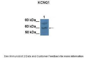 Lanes:   100 ug CHO cell lysate  Primary Antibody Dilution:   1:1000  Secondary Antibody:   Goat anti-rabbit HRP  Secondary Antibody Dilution:   1:25000  Gene Name:   KCNQ1  Submitted by:   Anonymous (KCNQ1 抗体  (N-Term))