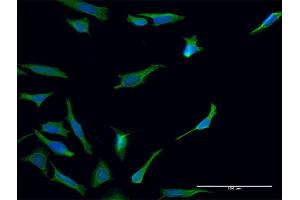 Immunofluorescence of monoclonal antibody to TGM2 on HeLa cell. (Transglutaminase 2 抗体  (AA 1-120))