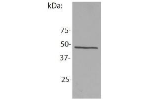 Western blotting analysis of NCK1 in whole cell lysate of mouse lymph node lymphocytes using the antibody EM-06 . (NCK1 抗体)