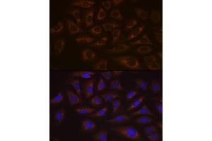 Immunofluorescence analysis of U-2 OS cells using UBE2C Rabbit mAb (ABIN1680590, ABIN3019392, ABIN3019393 and ABIN7101768) at dilution of 1:100 (40x lens). (UBE2C 抗体)
