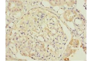 Immunohistochemistry of paraffin-embedded human kidney tissue using ABIN7149924 at dilution of 1:100 (DPYS 抗体  (AA 250-519))