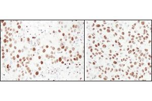 Immunohistochemistry (IHC) image for anti-Minichromosome Maintenance Complex Component 6 (MCM6) (C-Term) antibody (ABIN7453531)