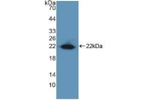 Western blot analysis of recombinant Human EGR1. (EGR1 抗体  (AA 282-433))