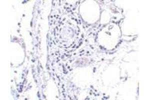 Immunohistochemistry of FABP7 in human breast tissue with FABP7 antibody at 5 μg/ml. (FABP7 抗体  (Center))