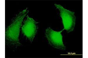 Immunofluorescence of purified MaxPab antibody to OSTF1 on HeLa cell. (OSTF1 抗体  (AA 1-217))