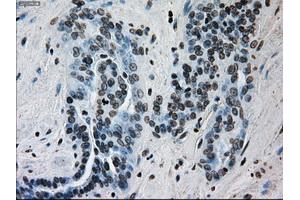 Immunohistochemical staining of paraffin-embedded Kidney tissue using anti-ERCC1 mouse monoclonal antibody. (ERCC1 抗体)