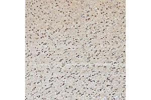 IHC analysis of SNRPA1 using anti-SNRPA1 antibody (ABIN7599131).