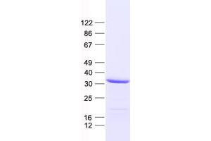 Western Blotting (WB) image for Solute Carrier Family 25, Member 38 (SLC25A38) protein (His tag) (ABIN2732164)