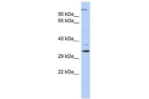 Western Blotting (WB) image for anti-Actin Related Protein 2/3 Complex, Subunit 2, 34kDa (ARPC2) (N-Term) antibody (ABIN631598)