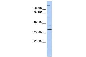 ARPC2 antibody used at 1 ug/ml to detect target protein. (ARPC2 抗体  (N-Term))