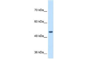 WB Suggested Anti-SPPL2B Antibody Titration:  1 ug/ml  Positive Control:  Jurkat cell lysate SPPL2B is supported by BioGPS gene expression data to be expressed in Jurkat (SPPL2B 抗体  (N-Term))