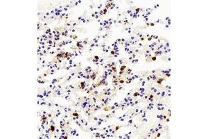 Immunohistochemistry of paraffin embedded mouse lung+LPS using LY6G (ABIN7074524) at dilution of 1:500 (400x lens) (Ly6g 抗体)
