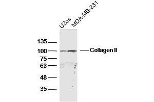 anti-Collagen, Type II (COL2) (AA 1401-1487) antibody