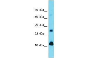Western Blotting (WB) image for anti-Vesicle-Associated Membrane Protein 1 (Synaptobrevin 1) (VAMP1) (N-Term) antibody (ABIN2501048) (VAMP1 抗体  (N-Term))