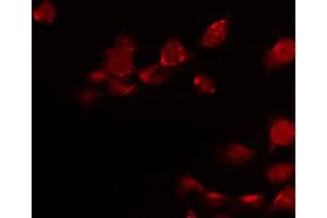 ABIN6272323 staining Hela by IF/ICC. (HOXD8 抗体  (Internal Region))