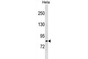 LRCH1 Antibody (Center) (ABIN1881505 and ABIN2839080) western blot analysis in Hela cell line lysates (35 μg/lane). (LRCH1 抗体  (AA 304-333))