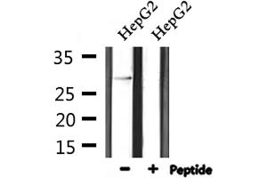 Western Blotting (WB) image for anti-Spi-C Transcription Factor (Spi-1/PU.1 Related) (SPIC) (Internal Region) antibody (ABIN6258474)