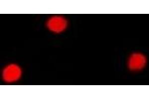 Immunofluorescent analysis of SNRPA staining in Hela cells. (SNRPA1 抗体)