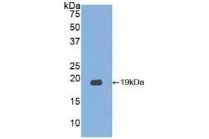 Detection of Recombinant RNASE3, Human using Polyclonal Antibody to Ribonuclease A3 (RNASE3) (RNASE3 抗体  (AA 30-154))