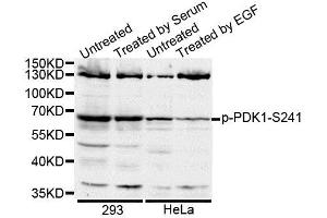 Western blot analysis of extracts of various cell lines, using Phospho-PDK1-S241 antibody (ABIN5995588). (PDPK1 抗体  (pSer241))
