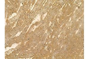 TNNI2 Mouse Monoclonal Antibody at 1/100 staining rat heart tissue by IHC-P. (TNNI2 抗体)