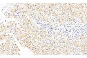 Immunohistochemistry (IHC) image for anti-Monoglyceride Lipase (MGLL) (Internal Region) antibody (ABIN334436)
