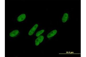 Immunofluorescence of purified MaxPab antibody to ZNF777 on HepG2 cell. (ZNF777 抗体  (AA 1-518))