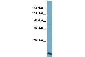 Host:  Rabbit  Target Name:  VPS41  Sample Type:  ACHN Whole Cell lysates  Antibody Dilution:  1. (VPS41 抗体  (N-Term))