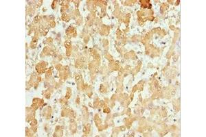 Immunohistochemistry of paraffin-embedded human liver tissue using ABIN7146127 at dilution of 1:100 (CXCL14 抗体  (AA 35-111))
