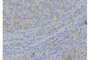 ABIN6273365 at 1/100 staining Human gastric tissue by IHC-P. (NDUFA10 抗体  (C-Term))