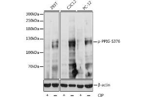 Western blot analysis of extracts of various cell lines, using Phospho-PPIG-S376 antibody (ABIN7269214) at 1:1000 dilution.