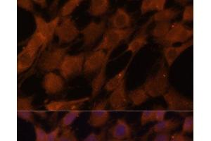 Immunofluorescence analysis of C6 cells using LGMN Polyclonal Antibody at dilution of 1:100 (40x lens).