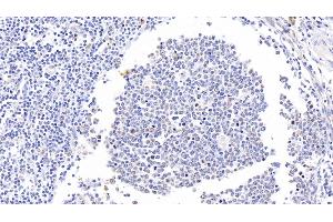Detection of CD11b in Human Tonsil Tissue using Polyclonal Antibody to Integrin Alpha M (CD11b)