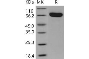 Western Blotting (WB) image for EPH Receptor B4 (EPHB4) (Active) protein (His tag) (ABIN7195557)