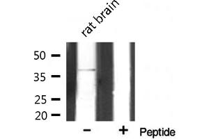 Western blot analysis on rat brain lysate using AOS1 Antibody (SAE1 抗体  (Internal Region))