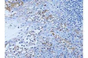 Immunohistochemistry of paraffin-embedded human tonsil using HADH antibody. (HADH 抗体)