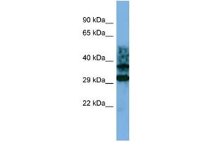 Host: Rabbit Target Name: CRYZL1 Sample Type: Jurkat Whole cell lysates Antibody Dilution: 1. (CRYZL1 抗体  (C-Term))