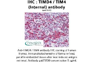 Image no. 2 for anti-T-Cell Immunoglobulin and Mucin Domain Containing 4 (TIMD4) (Internal Region) antibody (ABIN1740078) (TIMD4 抗体  (Internal Region))