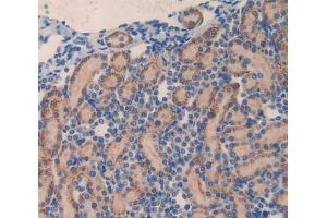 Used in DAB staining on fromalin fixed paraffin- embedded kidney tissue (MMP23A 抗体  (AA 71-383))
