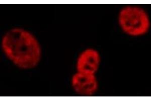 ABIN6269079 staining HeLa cells by IF/ICC. (Lamin A/C 抗体  (Internal Region))