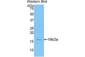 Detection of Recombinant HMGA2, Human using Polyclonal Antibody to High Mobility Group AT Hook Protein 2 (HMGA2) (HMGA2 抗体  (AA 1-109))