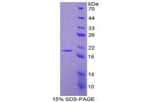 SDS-PAGE (SDS) image for Nitric Oxide Synthase 2, Inducible (NOS2) (AA 530-693) protein (His tag) (ABIN1980849) (NOS2 Protein (AA 530-693) (His tag))