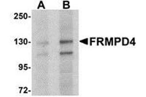 Western blot analysis of FRMPD4 in SK-N-SH cell lysate with AP30349PU-N FRMPD4 antibody at (A) 1 and (B) 2 μg/ml. (FRMPD4 抗体  (Center))