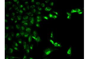 Immunofluorescence analysis of MCF-7 cell using FCGR1A antibody. (FCGR1A 抗体  (AA 200-292))
