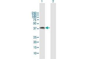 Western Blot analysis of NOV expression in transfected 293T cell line by NOV MaxPab polyclonal antibody. (NOV 抗体  (AA 1-357))